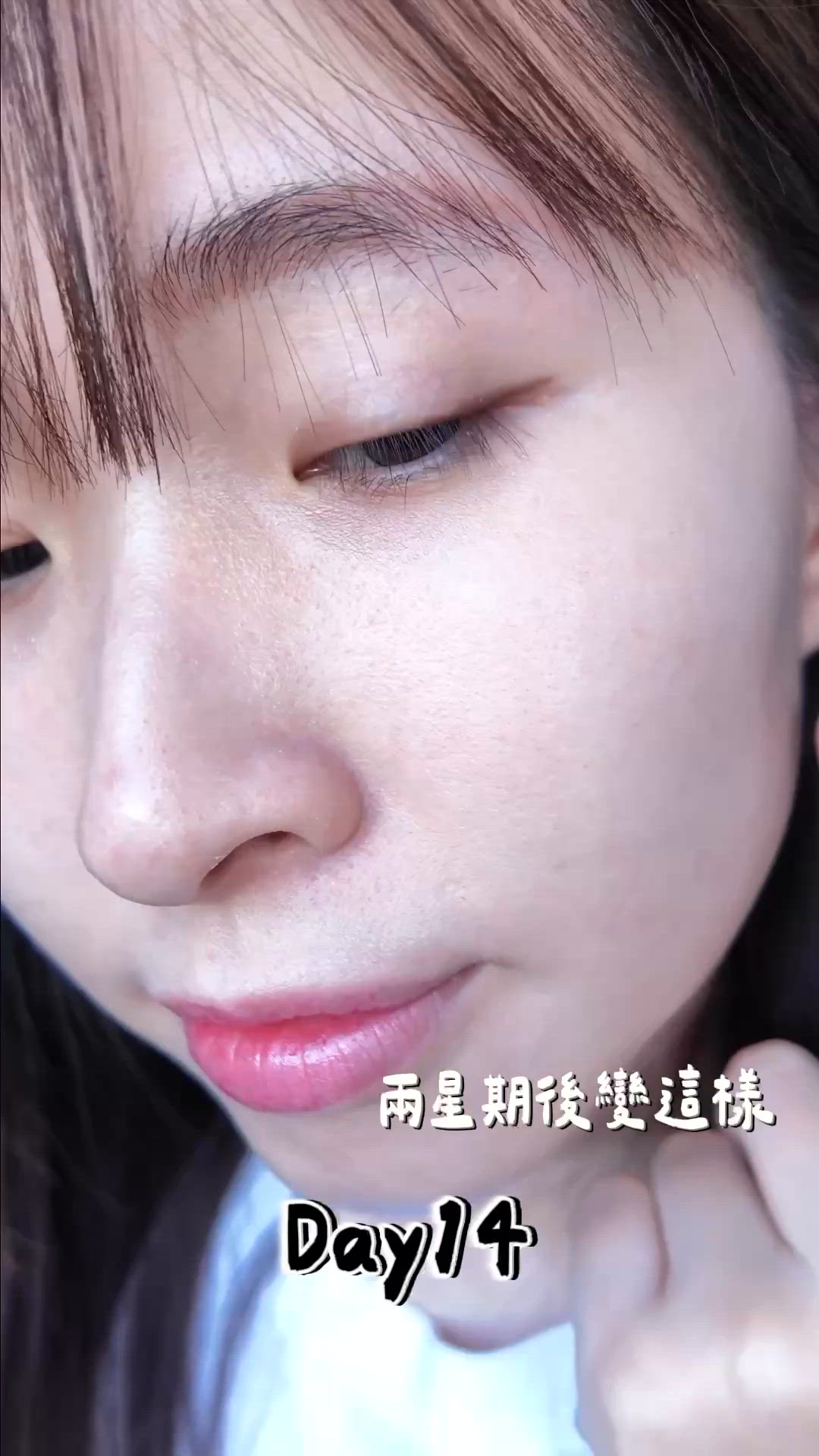 14天改善粗大毛孔！Meditherapy 全方位微毛孔組合