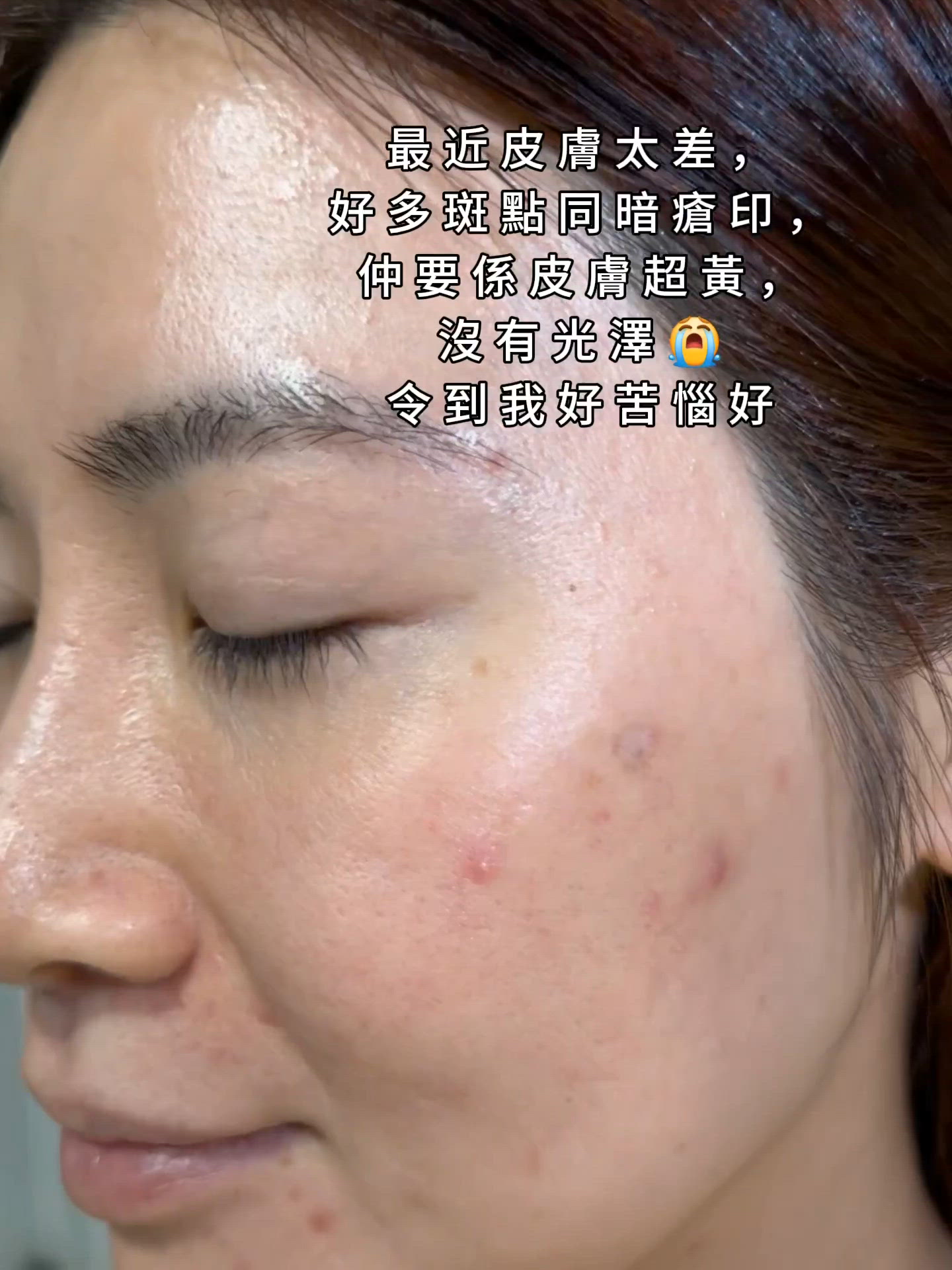🌟【9日見效！斑點、暗沉、黃氣 Bye Bye！】🌟